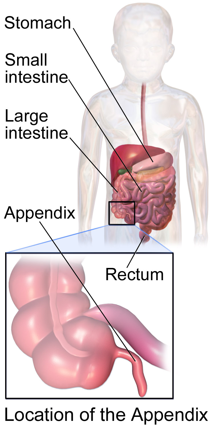 A diagram showing the appendix's location in the human gut, with a labelled close-up.