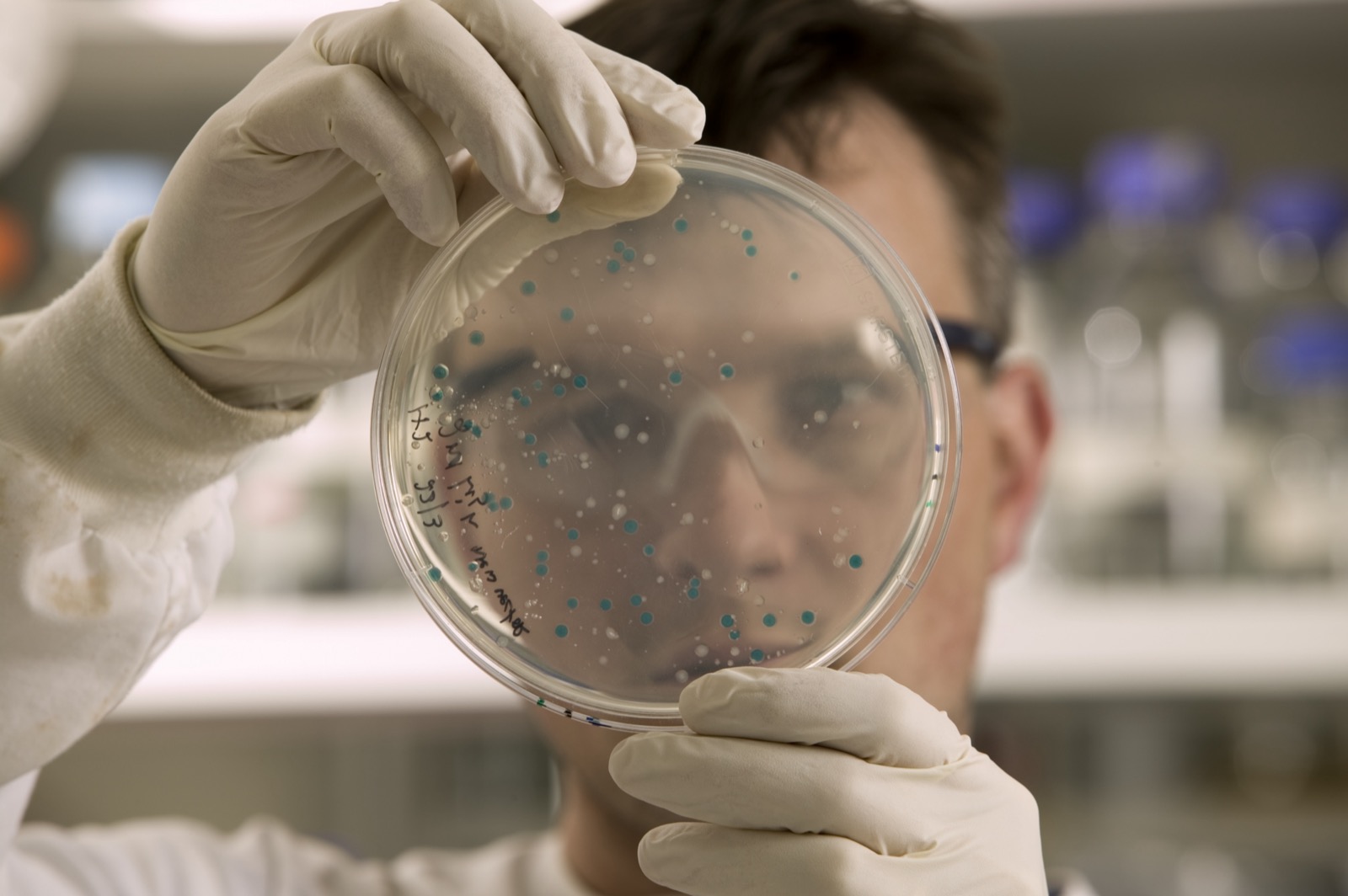 A scientist examining colonies of bacteria growing on an agar dish.