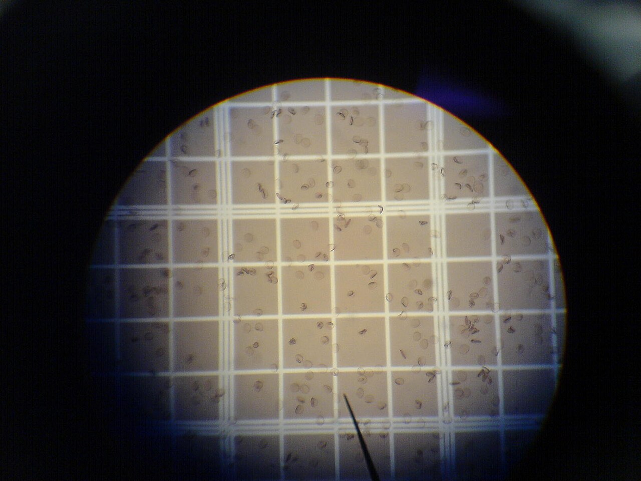 Red blood cells under a microscope, their iron-rich haemoglobin makes blood red.