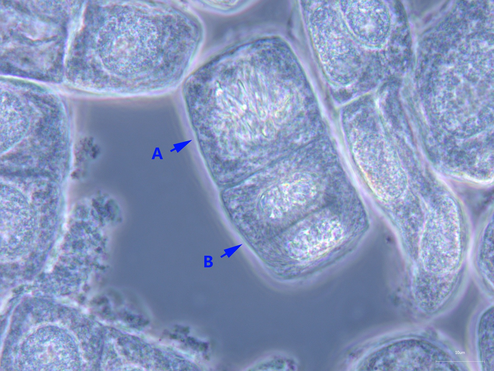 Microscope view of plant cells, with arrows pointing to two cells caught in the act of dividing in two.