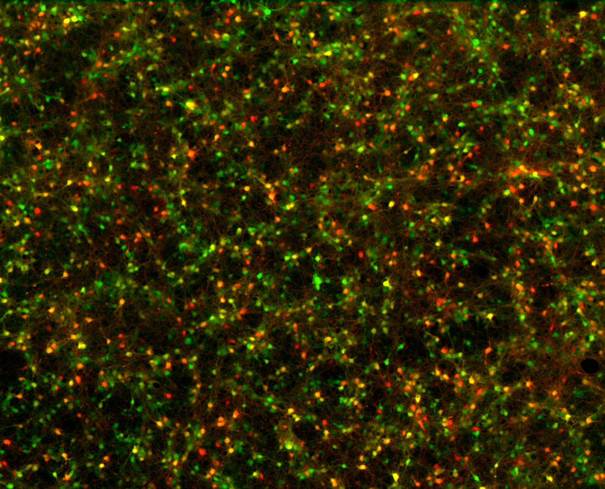 Hundreds of brain cells glowing green and red under a microscope, their fine threads tangling together into a dense network