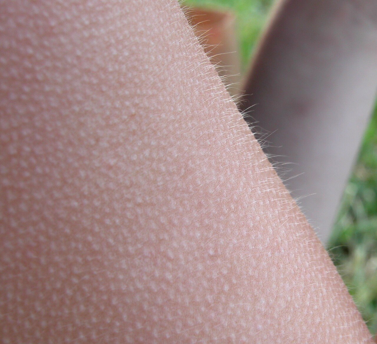 A close-up of goosebumps on human skin with fine hairs standing up