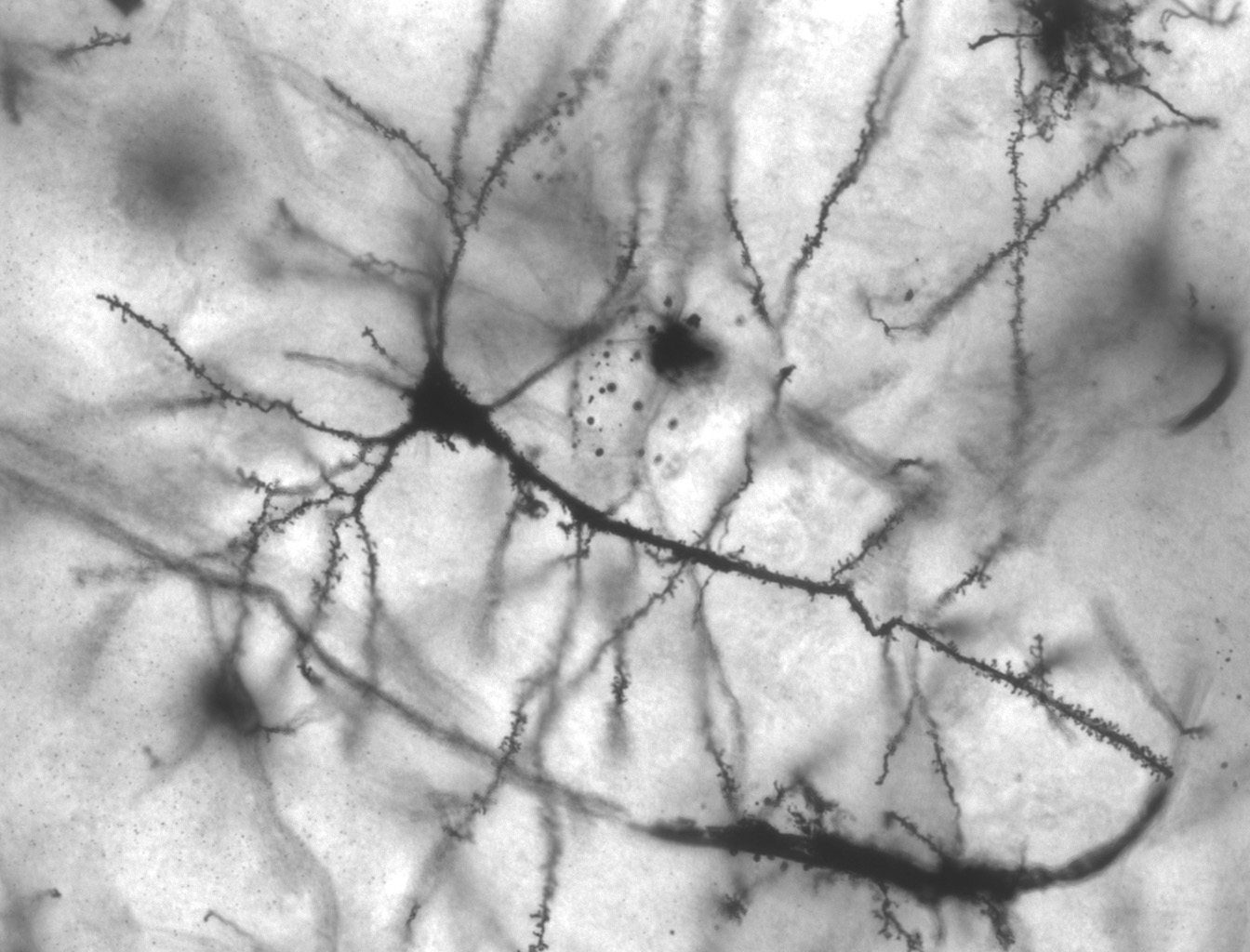A single brain cell stained dark under a microscope, its branches spreading out in every direction to meet thousands of others