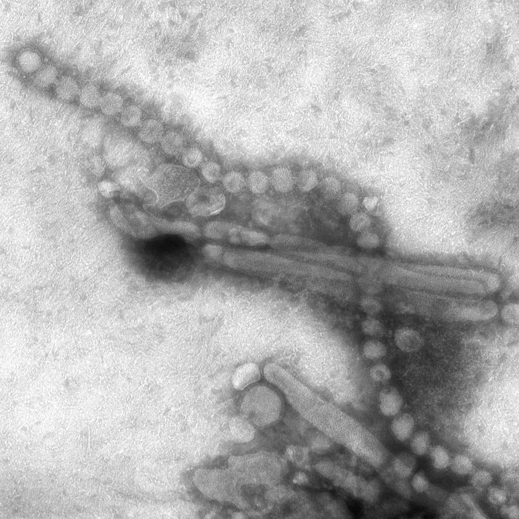Influenza virus particles under an electron microscope, small round and rod-shaped blobs clustered together in grey