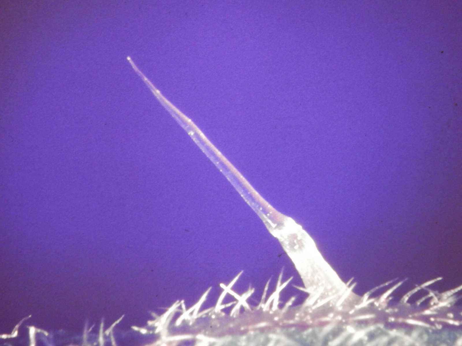 A microscope close-up of a single nettle stinging hair, a sharp hollow needle rising from smaller hairs on the leaf.