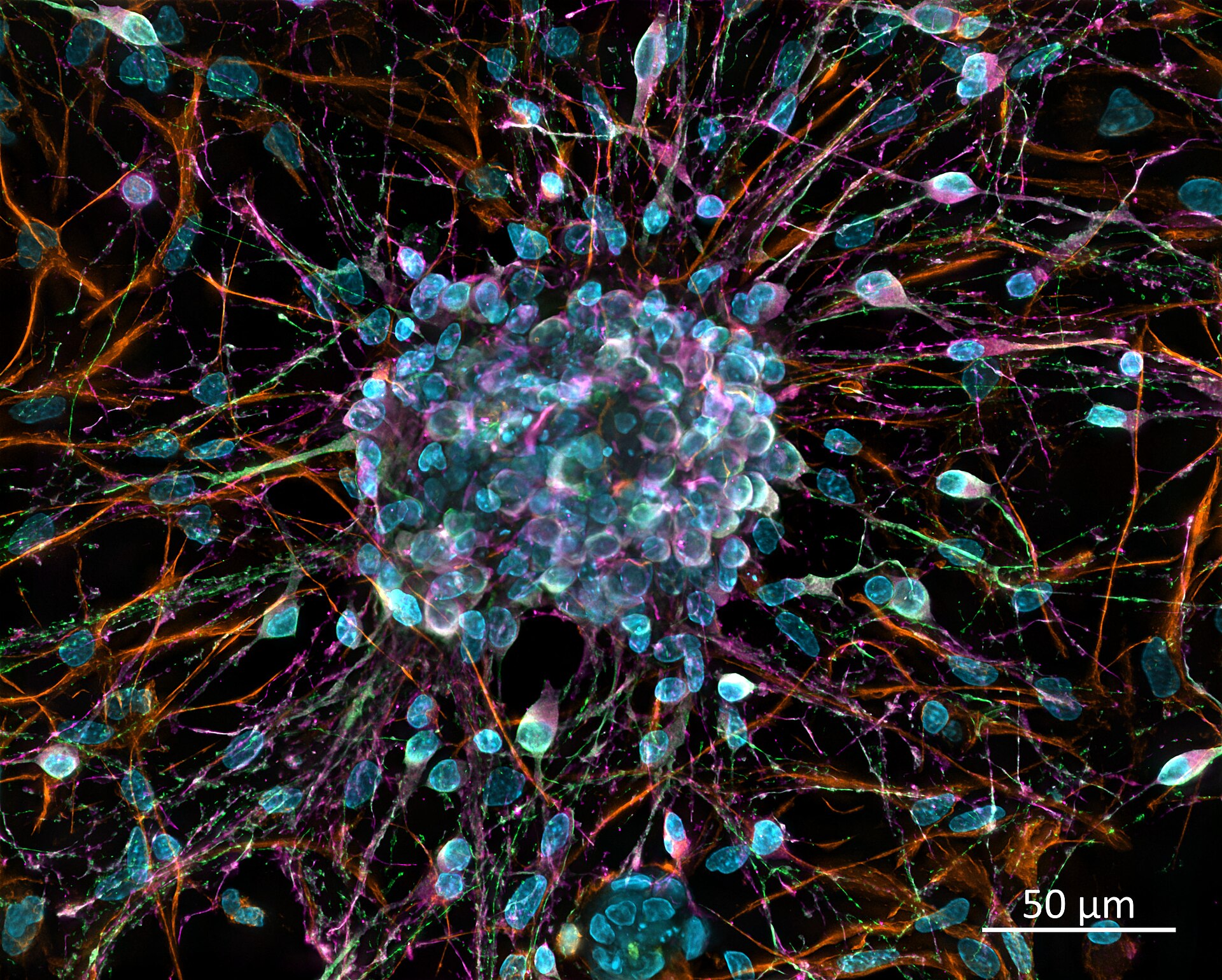 A fluorescent microscope image of nerve cells: blue cell bodies clustered together with orange and magenta fibres radiating outwards, with a 50 micrometre scale bar.