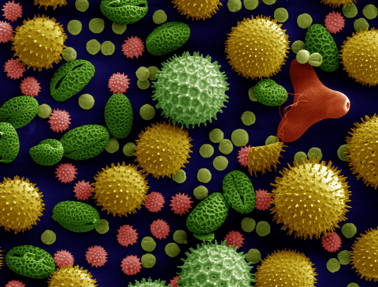 Pollen grains under an electron microscope, colourised yellow, green and pink, some spiky like sea urchins and some smooth as beans