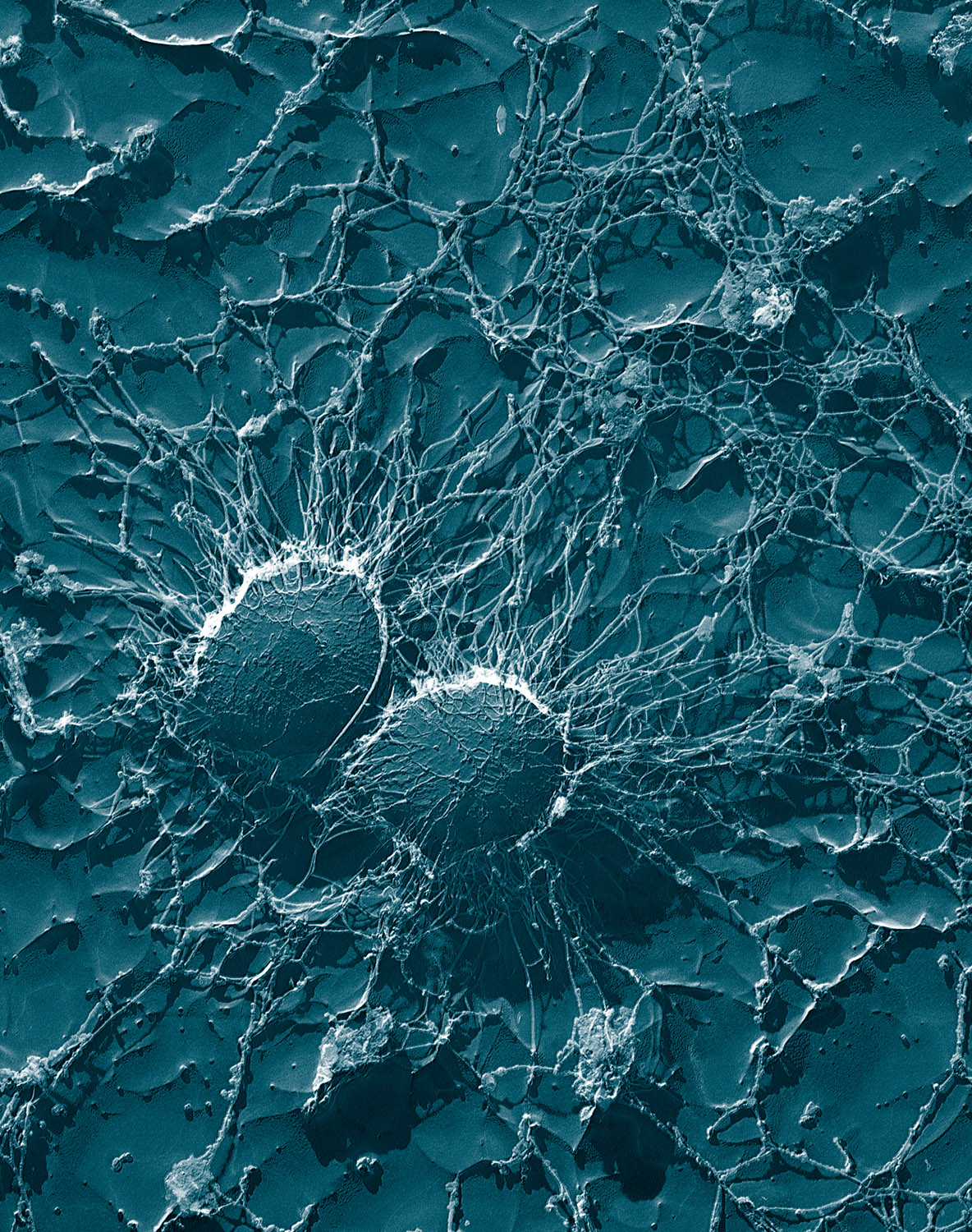 A blue-tinted electron microscope image of round Staphylococcus bacteria caught in a fine mesh of fibres.