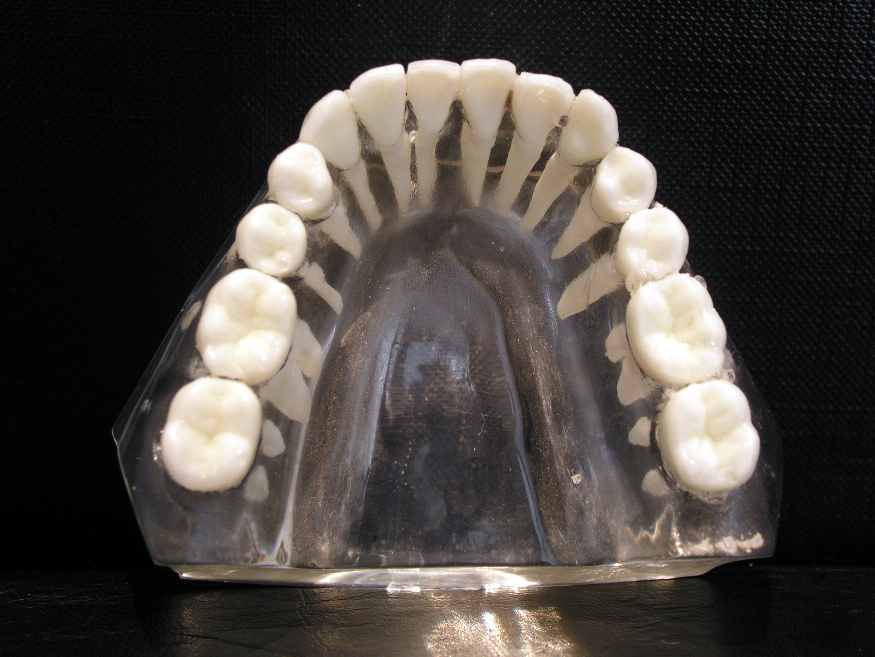 A clear dental model showing a full arch of teeth, flat and chisel-like at the front and wide and bumpy towards the back